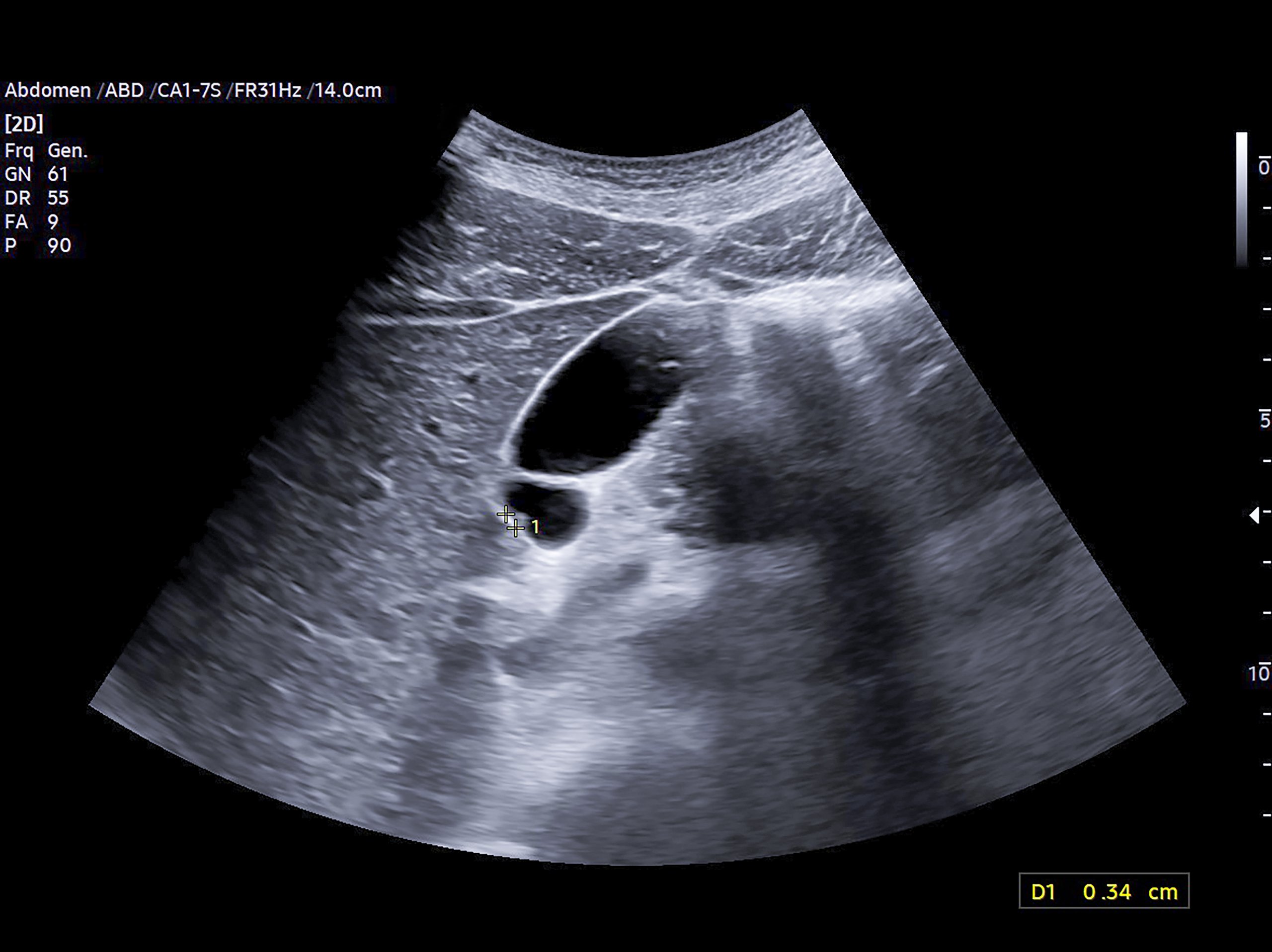 Obstetricia